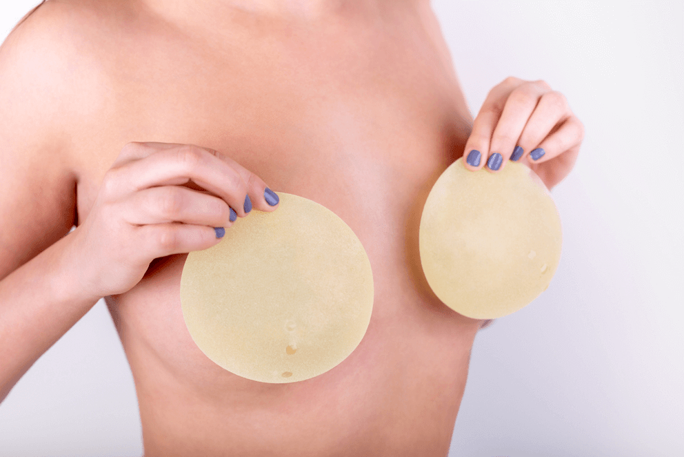 An endoprosthesis option