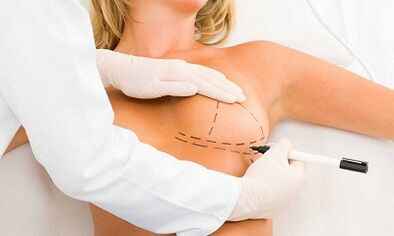 How to increase the cerebral of implants